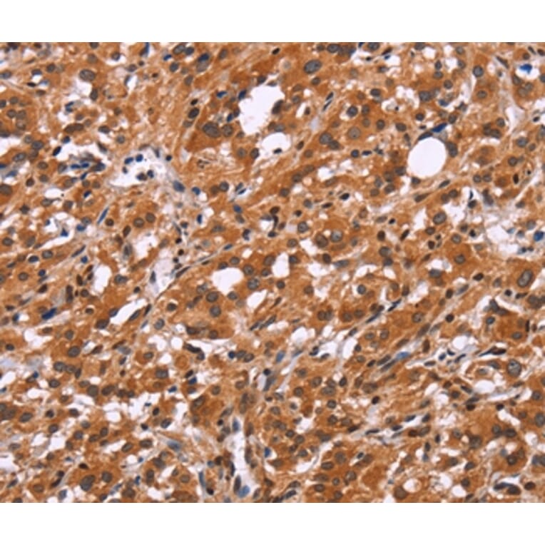 Immunohistochemistry - SLC8A2 Antibody from Signalway Antibody (37177) - Antibodies.com