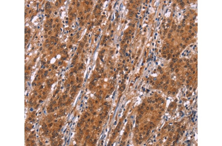 Immunohistochemistry - SLC8A2 Antibody from Signalway Antibody (37177) - Antibodies.com