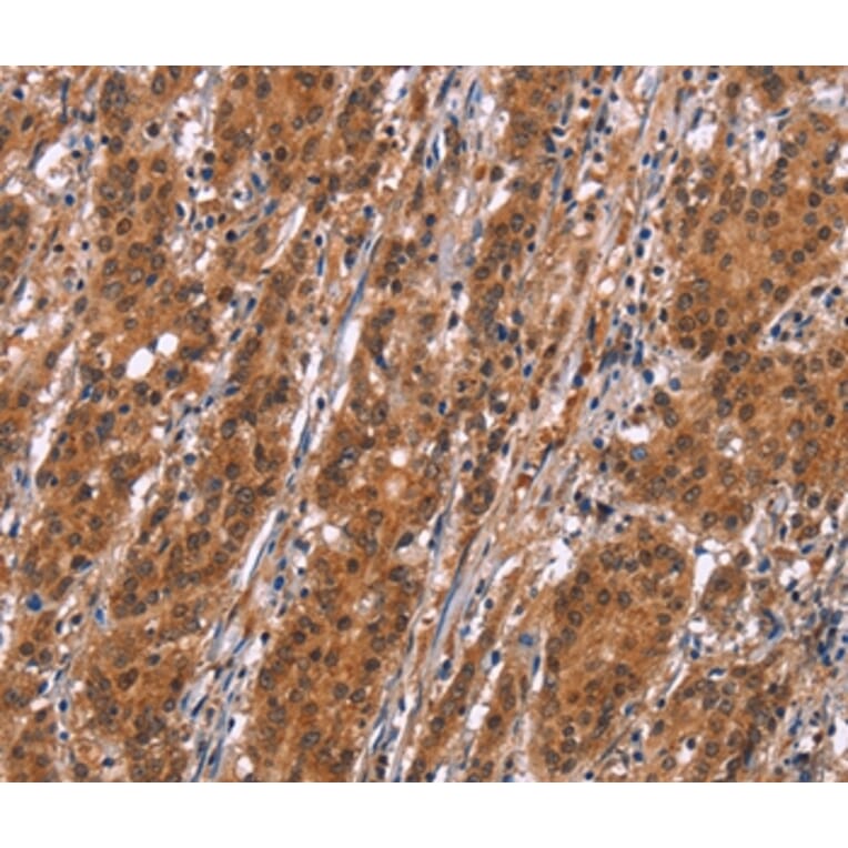 Immunohistochemistry - SLC8A2 Antibody from Signalway Antibody (37177) - Antibodies.com