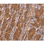 Immunohistochemistry - SLC8A2 Antibody from Signalway Antibody (37177) - Antibodies.com