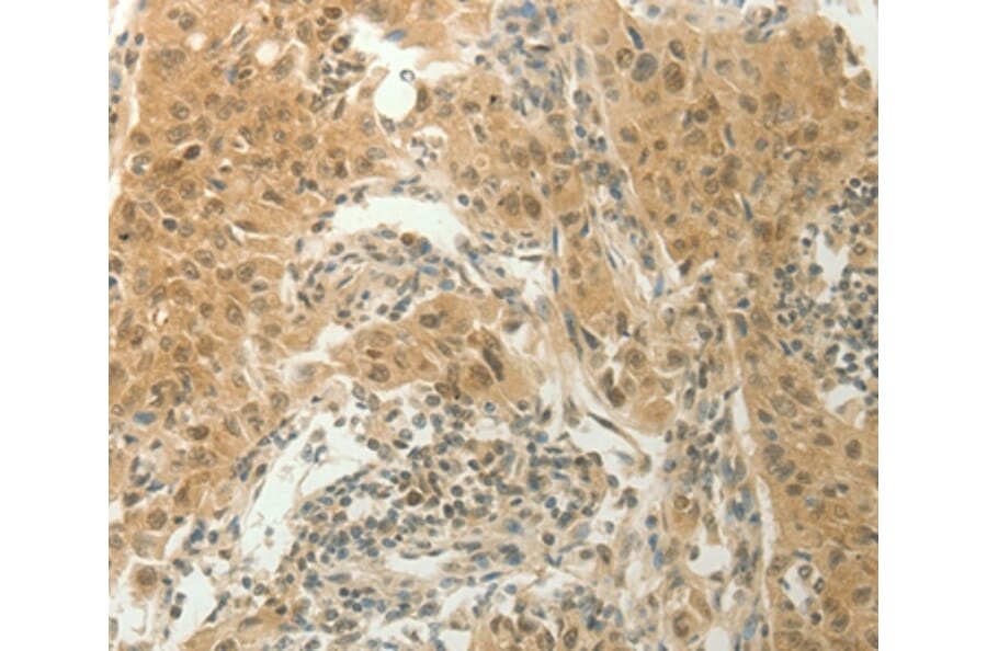 Immunohistochemistry - SLC8A3 Antibody from Signalway Antibody (37178) - Antibodies.com