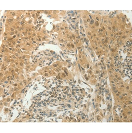 Immunohistochemistry - SLC8A3 Antibody from Signalway Antibody (37178) - Antibodies.com