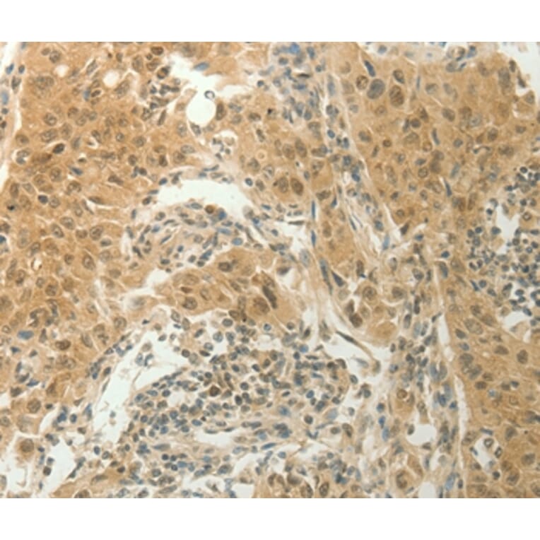 Immunohistochemistry - SLC8A3 Antibody from Signalway Antibody (37178) - Antibodies.com
