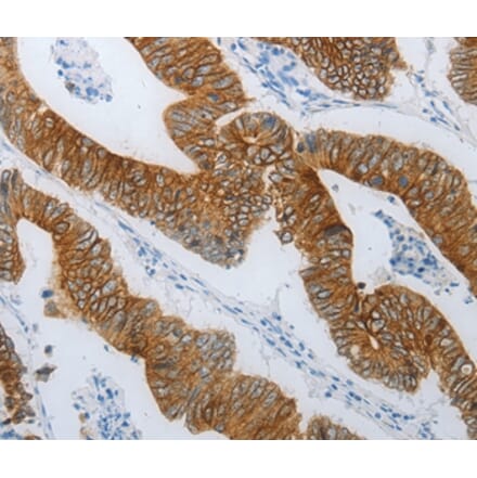 Immunohistochemistry - TMEM8B Antibody from Signalway Antibody (37186) - Antibodies.com