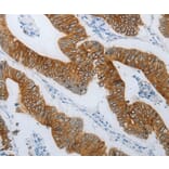 Immunohistochemistry - TMEM8B Antibody from Signalway Antibody (37186) - Antibodies.com