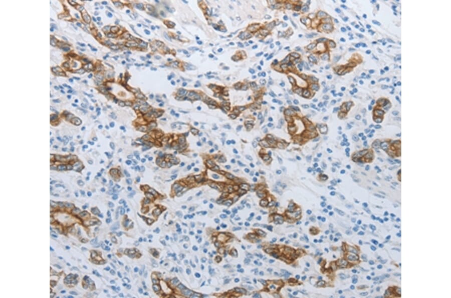 Immunohistochemistry - TMEM8B Antibody from Signalway Antibody (37186) - Antibodies.com
