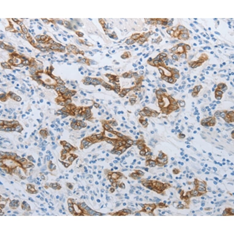 Immunohistochemistry - TMEM8B Antibody from Signalway Antibody (37186) - Antibodies.com
