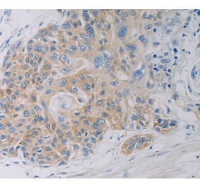Immunohistochemistry - CLEC4C Antibody from Signalway Antibody (37198) - Antibodies.com