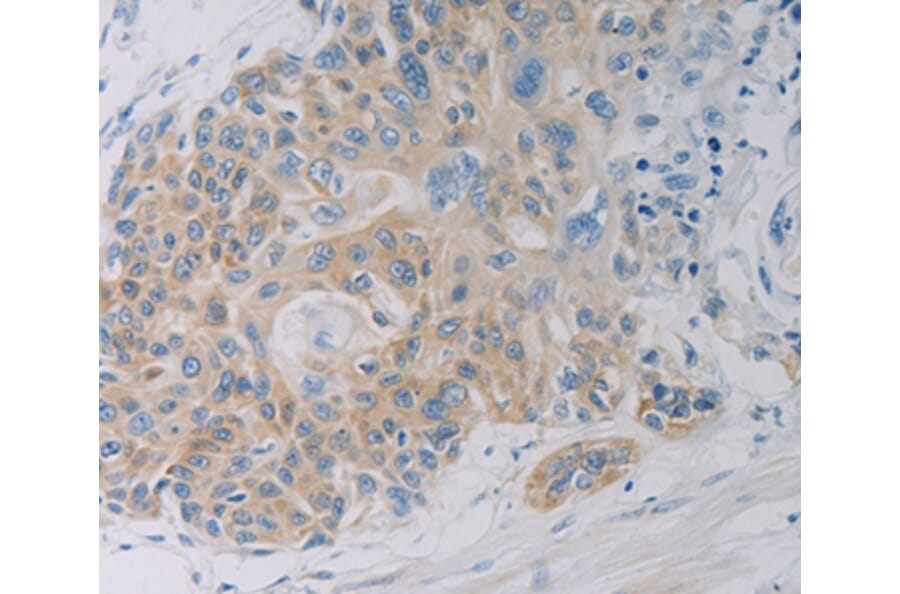 Immunohistochemistry - CLEC4C Antibody from Signalway Antibody (37198) - Antibodies.com