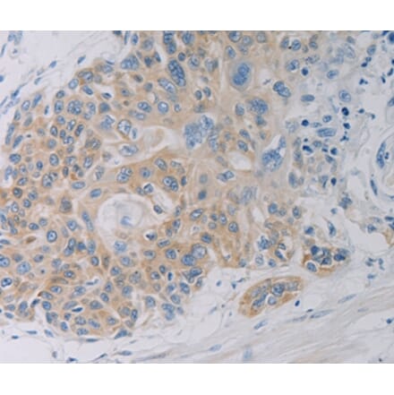 Immunohistochemistry - CLEC4C Antibody from Signalway Antibody (37198) - Antibodies.com