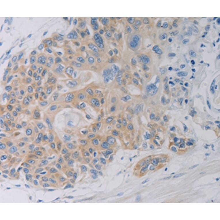 Immunohistochemistry - CLEC4C Antibody from Signalway Antibody (37198) - Antibodies.com