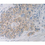 Immunohistochemistry - CLEC4C Antibody from Signalway Antibody (37198) - Antibodies.com