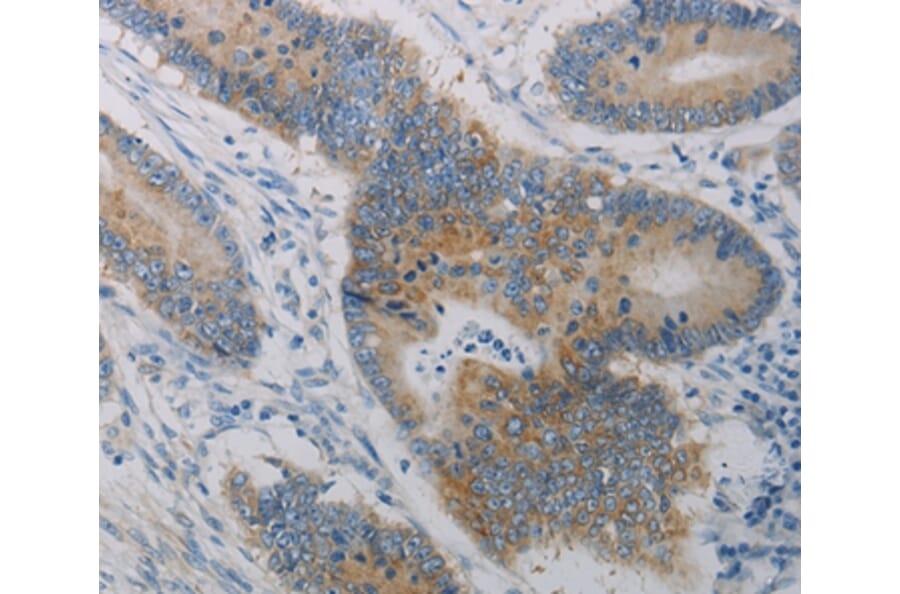 Immunohistochemistry - CLEC4C Antibody from Signalway Antibody (37198) - Antibodies.com