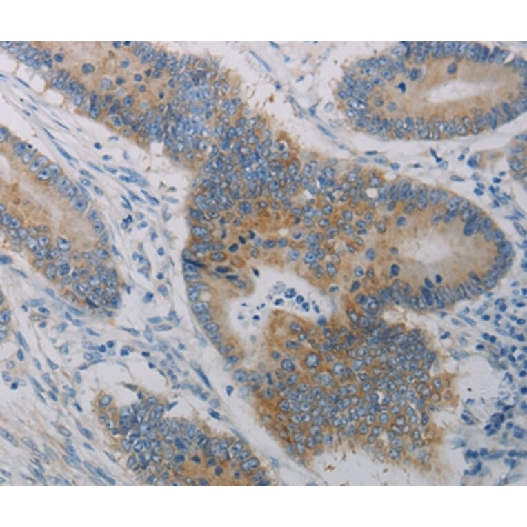 Immunohistochemistry - CLEC4C Antibody from Signalway Antibody (37198) - Antibodies.com