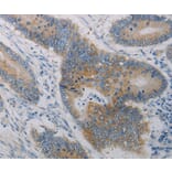 Immunohistochemistry - CLEC4C Antibody from Signalway Antibody (37198) - Antibodies.com