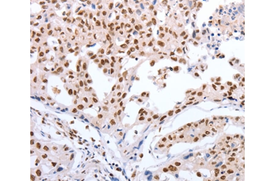 Immunohistochemistry - POU3F1 Antibody from Signalway Antibody (37201) - Antibodies.com