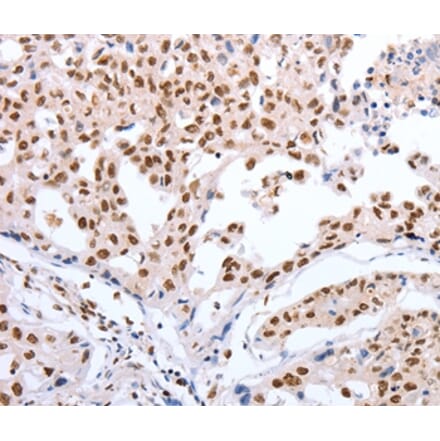 Immunohistochemistry - POU3F1 Antibody from Signalway Antibody (37201) - Antibodies.com