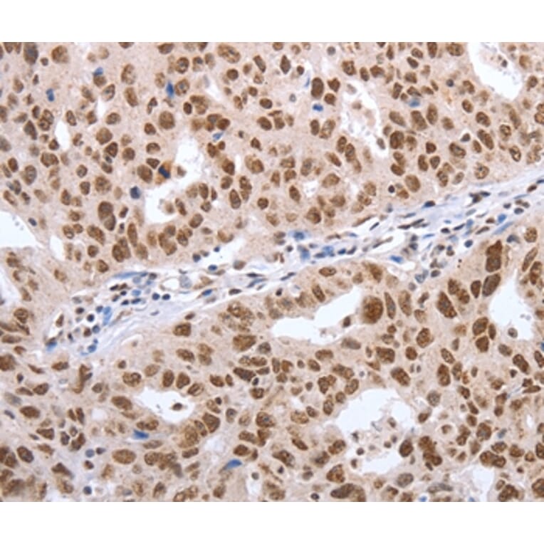 Immunohistochemistry - POU3F1 Antibody from Signalway Antibody (37201) - Antibodies.com