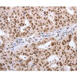 Immunohistochemistry - POU3F1 Antibody from Signalway Antibody (37201) - Antibodies.com