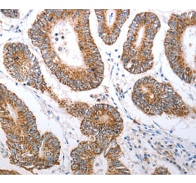 Immunohistochemistry - HCRTR1 Antibody from Signalway Antibody (37203) - Antibodies.com