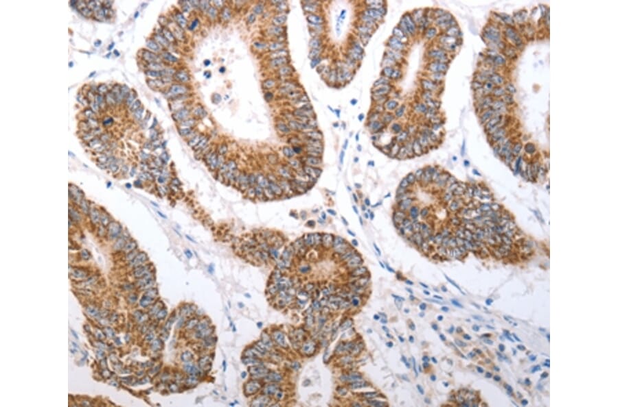 Immunohistochemistry - HCRTR1 Antibody from Signalway Antibody (37203) - Antibodies.com