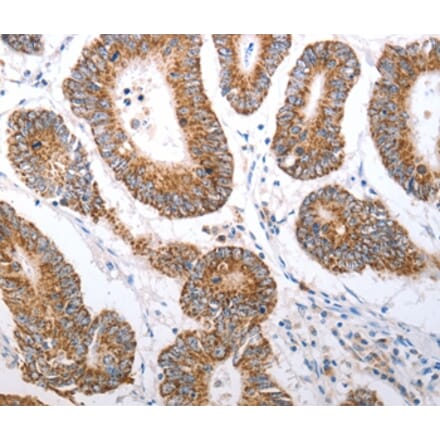 Immunohistochemistry - HCRTR1 Antibody from Signalway Antibody (37203) - Antibodies.com