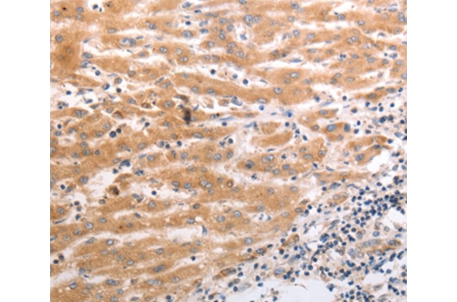 Immunohistochemistry - HCRTR1 Antibody from Signalway Antibody (37203) - Antibodies.com