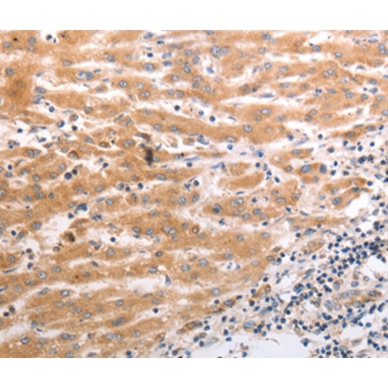 Immunohistochemistry - HCRTR1 Antibody from Signalway Antibody (37203) - Antibodies.com