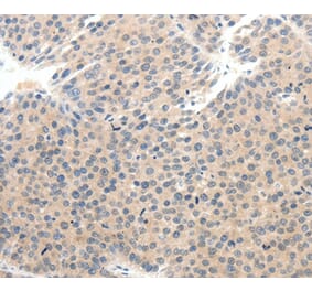Immunohistochemistry - SCN10A Antibody from Signalway Antibody (37234) - Antibodies.com