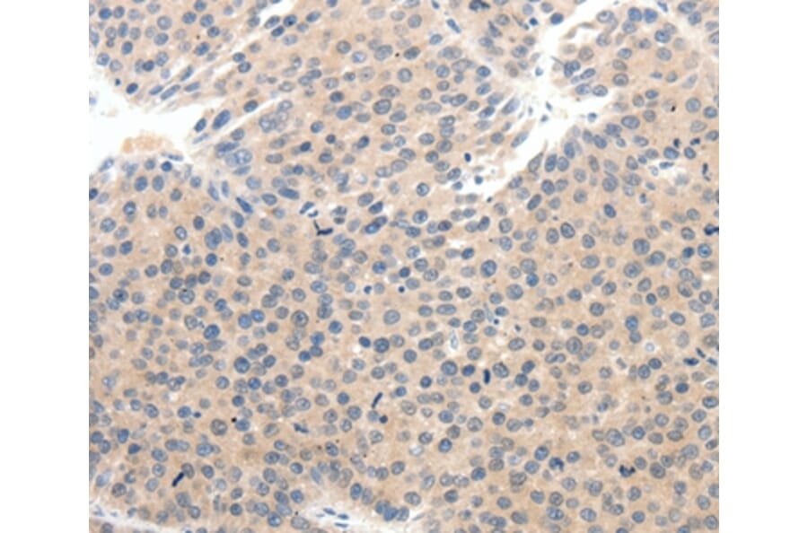 Immunohistochemistry - SCN10A Antibody from Signalway Antibody (37234) - Antibodies.com