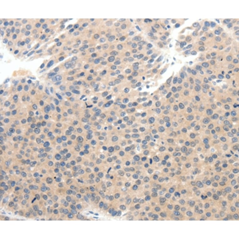 Immunohistochemistry - SCN10A Antibody from Signalway Antibody (37234) - Antibodies.com