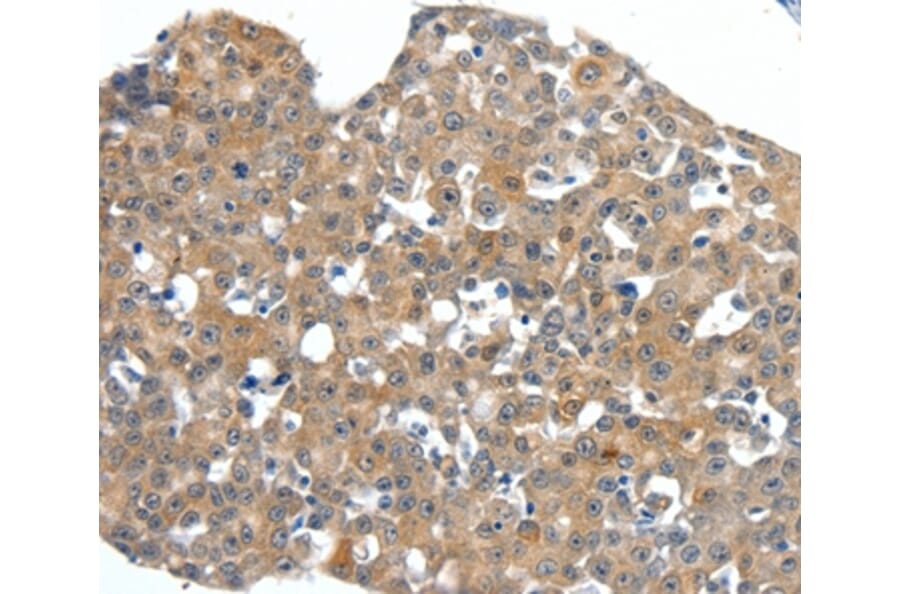 Immunohistochemistry - SCN11A Antibody from Signalway Antibody (37235) - Antibodies.com