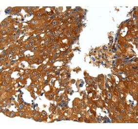 Immunohistochemistry - CXCL12 Antibody from Signalway Antibody (37236) - Antibodies.com