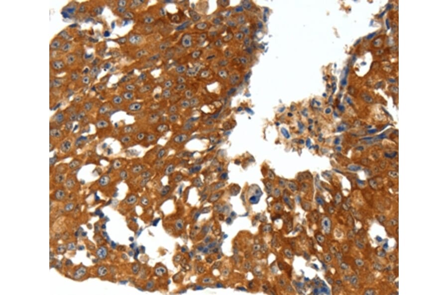 Immunohistochemistry - CXCL12 Antibody from Signalway Antibody (37236) - Antibodies.com