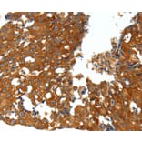 Immunohistochemistry - CXCL12 Antibody from Signalway Antibody (37236) - Antibodies.com