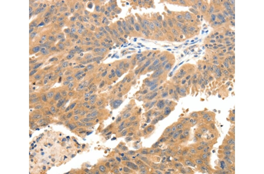 Immunohistochemistry - CXCL12 Antibody from Signalway Antibody (37236) - Antibodies.com