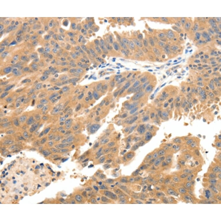 Immunohistochemistry - CXCL12 Antibody from Signalway Antibody (37236) - Antibodies.com