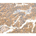Immunohistochemistry - CXCL12 Antibody from Signalway Antibody (37236) - Antibodies.com
