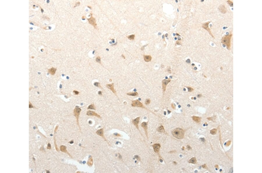 Immunohistochemistry - SEMA3D Antibody from Signalway Antibody (37239) - Antibodies.com