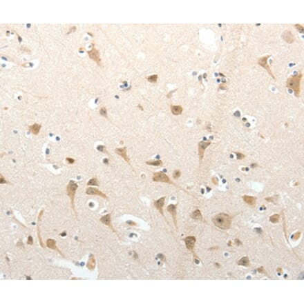 Immunohistochemistry - SEMA3D Antibody from Signalway Antibody (37239) - Antibodies.com