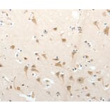 Immunohistochemistry - SEMA3D Antibody from Signalway Antibody (37239) - Antibodies.com