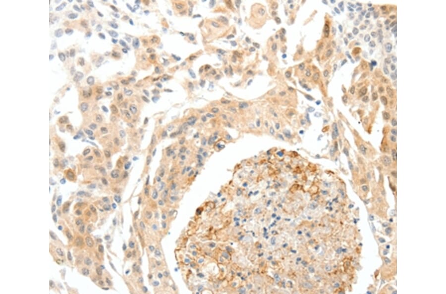 Immunohistochemistry - SEMA3D Antibody from Signalway Antibody (37239) - Antibodies.com