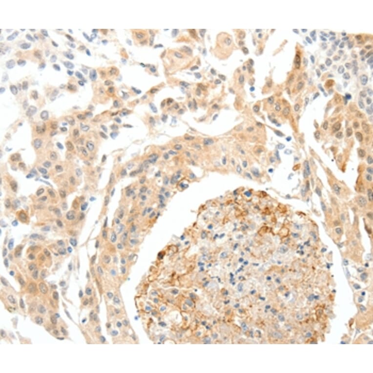 Immunohistochemistry - SEMA3D Antibody from Signalway Antibody (37239) - Antibodies.com