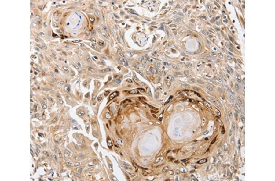 Immunohistochemistry - SLC1A7 Antibody from Signalway Antibody (37242) - Antibodies.com