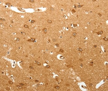 Immunohistochemical analysis of paraffin-embedded Human brain tissue using #37266 at dilution 1/60.