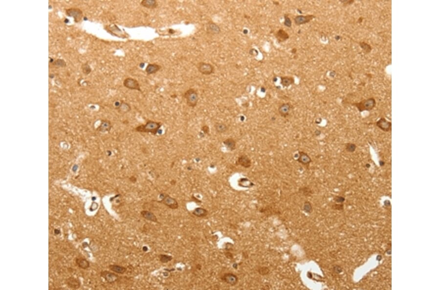 Immunohistochemistry - MAP1B Antibody from Signalway Antibody (37266) - Antibodies.com