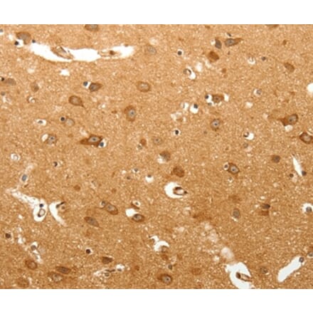 Immunohistochemistry - MAP1B Antibody from Signalway Antibody (37266) - Antibodies.com