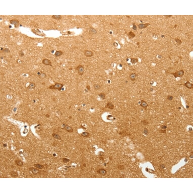 Immunohistochemistry - MAP1B Antibody from Signalway Antibody (37266) - Antibodies.com