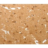 Immunohistochemistry - MAP1B Antibody from Signalway Antibody (37266) - Antibodies.com