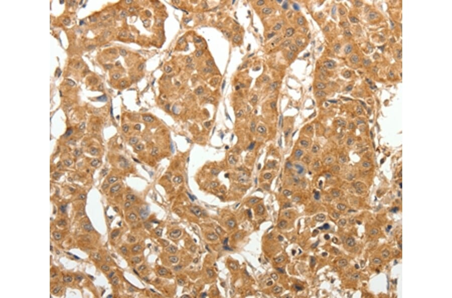 Immunohistochemistry - MAP1B Antibody from Signalway Antibody (37266) - Antibodies.com